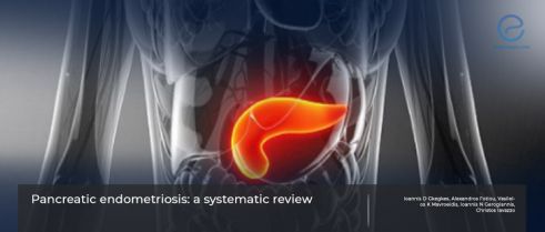 A rare and challenging site for endometriosis: Pancreas