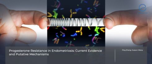 Endometriosis and Progesterone Resistance