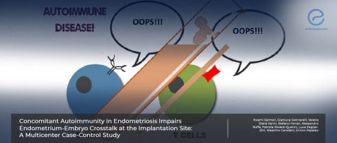 Autoimmune Disorders in Women with Endometriosis May Impair Embryo Implantation