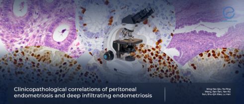 A pioneering study on clinicopathologic features of biopsies of endometriotic lesions 