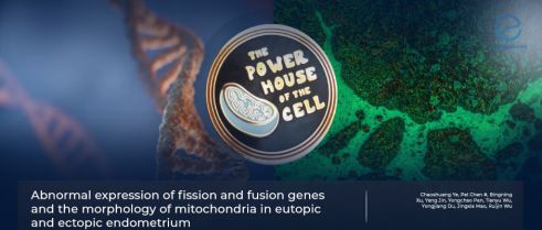 Alterations of mitochondrial dynamics in endometriosis