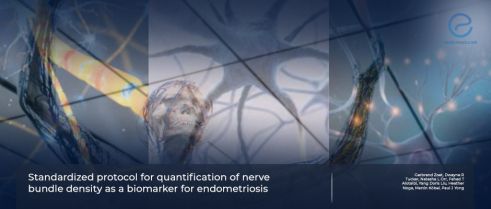 Quantification of nerve bundle density as a biomarker for endometriosis utilizing PGP9.5 immunostaining