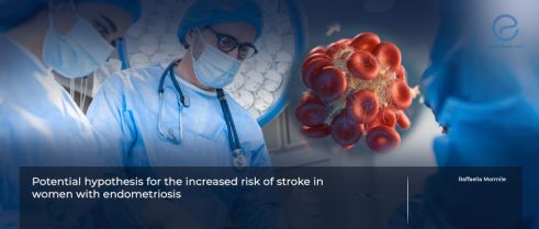 Why is there a higher risk of stroke for women with endometriosis? 
