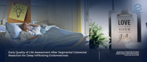 Surgery Pivotal in Improving Quality of Life in Endometriosis Patients