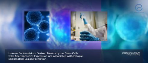 Study Sheds Light on the Molecular Mechanism of Endometriosis Lesion Formation