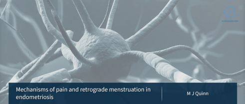 Chronic pelvic pain mechanisms in endometriosis
