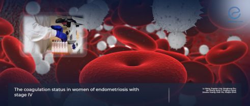 The role of coagulation factors and tumor markers in diagnosing advanced stage endometriosis