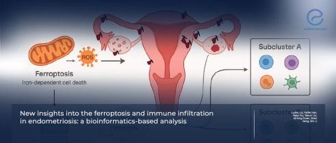 Ferroptosis: A New Mechanism Potentially Driving Endometriosis Progression