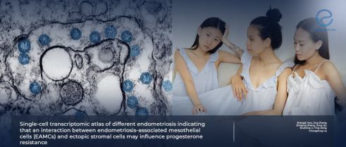 Mapping the Cellular Landscape of Endometriosis and Progesterone Resistance