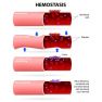 Platelets Promote the Development of Endometriosis