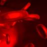 Agents Causing Red Blood Cell Lysis Worsens Endometriosis