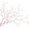 Reduced vascularization in ovarian endometriomas associated with less pain