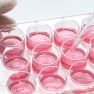 Research Sheds Light Onto Molecular Mechanism of Endometriosis 