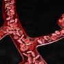 Blood vessels formation in endometriosis