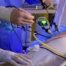 A How-To Guide for Endometriosis Surgery