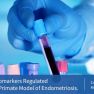 miRNAs, Could Be a Reliable Biomarker of Endometriosis