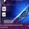 Exosomal miR-214 from endometrial stromal cells inhibits endometriosis fibrosis.