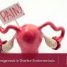 New Target for Endometriosis Treatment?