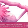 Fallopian Tube Capability in Women with Pelvic Endometriosis and Adenomyosis