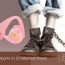 An overlooked symptom of endometriosis: Fatigue