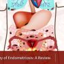 Endometriosis: A review on anatomic principles and the management