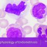 Immune dysregulation in endometriosis