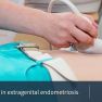 Extragenital endometriosis and ultrasound