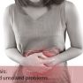 Bowel endometriosis: What you need to know