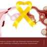 The predictors for the coexistence of uterine leiomyomas and endometriosis  