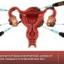 Nanotechnology as a tool for targeted therapy of endometriosis