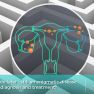 Recent advances in the diagnosis and treatment of endometriosis