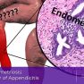 Appendiceal endometriosis