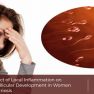 Local inflammation and follicle development in women with ovarian endometriosis 