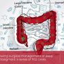 Prevalence, Risk factors and Management of Bowel Fistula after Rectosigmoid Surgery for Deep Endometriosis