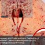 Adenomyosis: accuracy of the diagnostic methods and the synchronism with deep infiltrating endometriosis