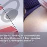 Fallopian tube occlusion in infertile women with endometriosis