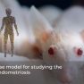 Researchers Develop New Mouse Model of Endometriosis