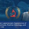 Understanding what we see: endometriosis laparoscopic appearance and microscopic verification