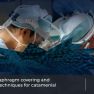 Novel surgical solutions for catamenial pneumothorax