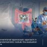 Robotic Surgery Not Linked With More Complications in Certain Cases