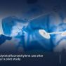Ovarian adhesion prevention with polytetrafluoroethylene during endometrioma surgery.