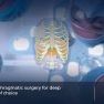 Diagnosis and management of treatment in diaphragmatic endometriosis.