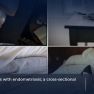 An often overlooked symptom: Sleep disorders in patients with endometriosis