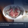 Endometriosis and musculoskeletal function of pelvic loin complex