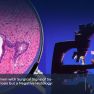 Clinical Endometriosis Despite Negative Histology: A Diagnostic Dilemma