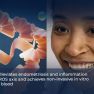 Targeting Osteopontin to Detect and Treat Endometriosis