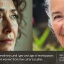 Surgical vs. Natural Menopause in Endometriosis