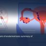 NICE Guideline Update Reframes Endometriosis Care in 2024