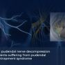 Laparoscopic Pudendal Neurolysis: A Solution for Entrapment-Related Pelvic Pain